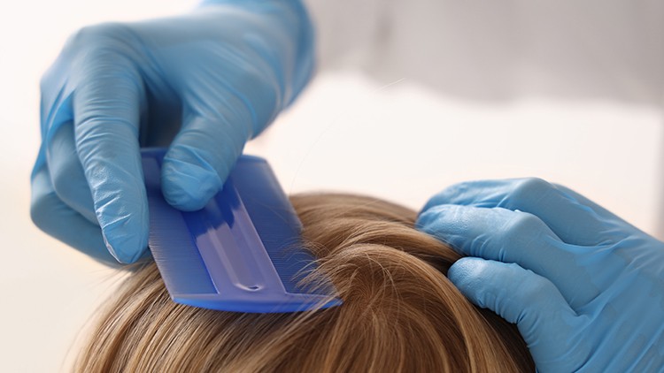 Blaue behandschuhte Hände kämmen mit einem blauen Läusekamm durch blondes Haar.